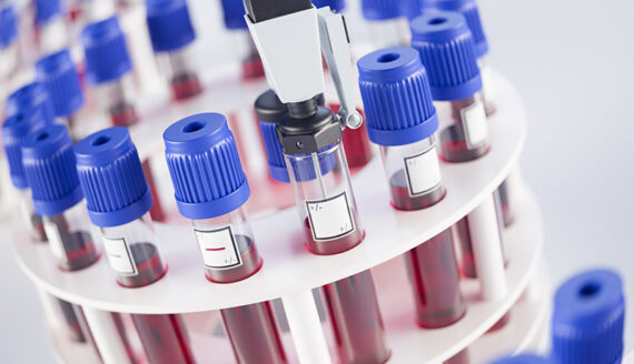 Vials on circular rack as part of purpose built QC panel looking for gabapentinoids